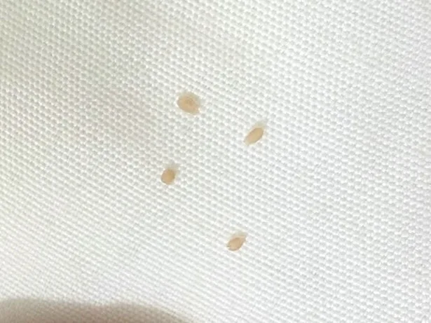 白色或金黃色的小節段是貓咪絛蟲感染的跡象